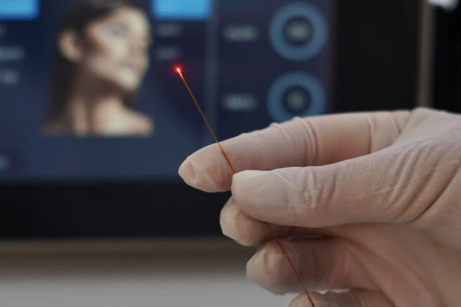 Endolift Treatment in Dubai