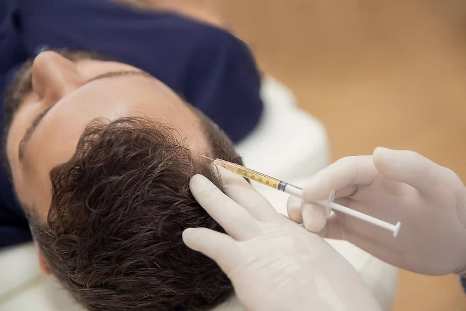 Exosomes Hair Treatment in Dubai